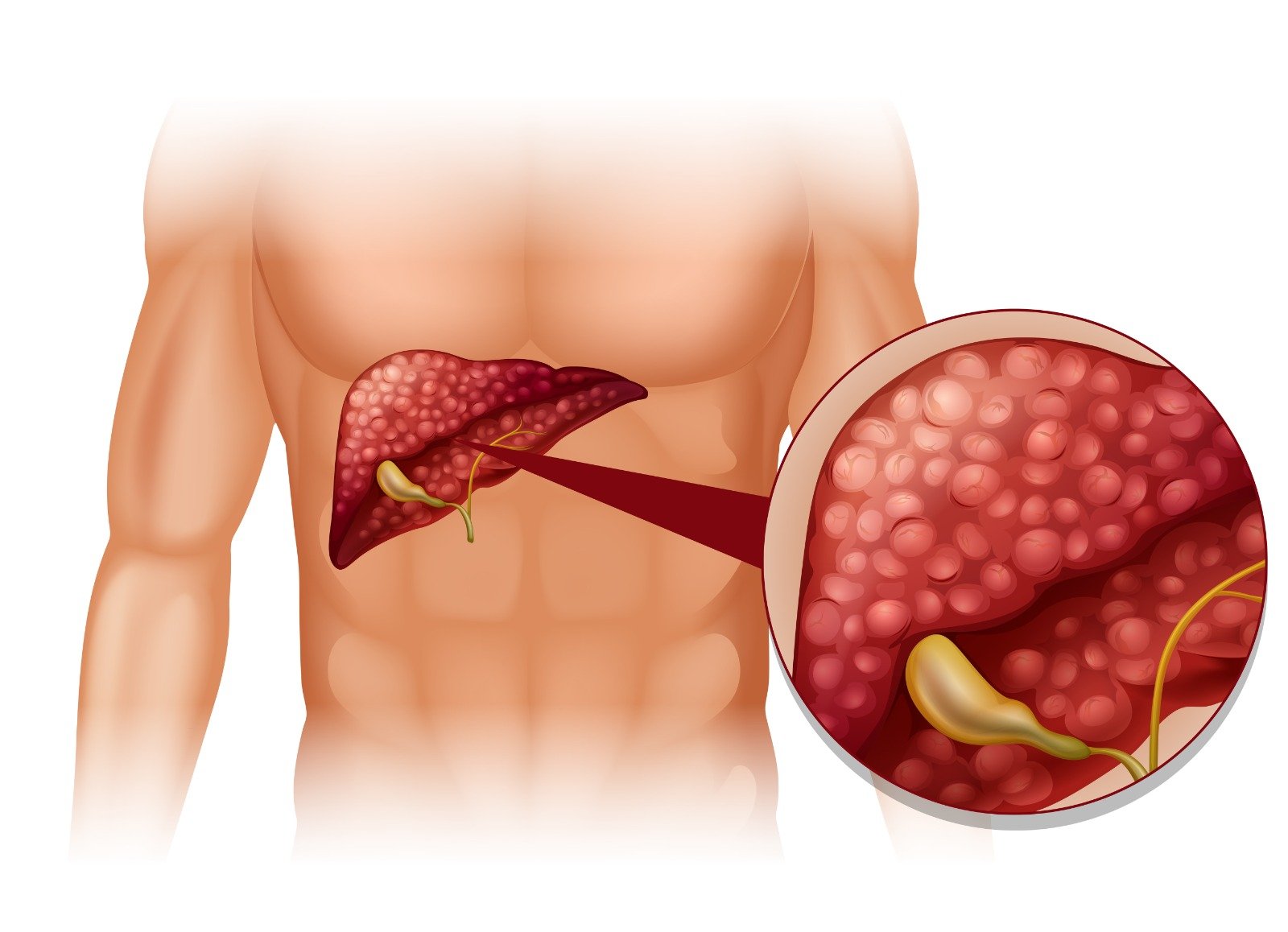 Upper Endoscopy